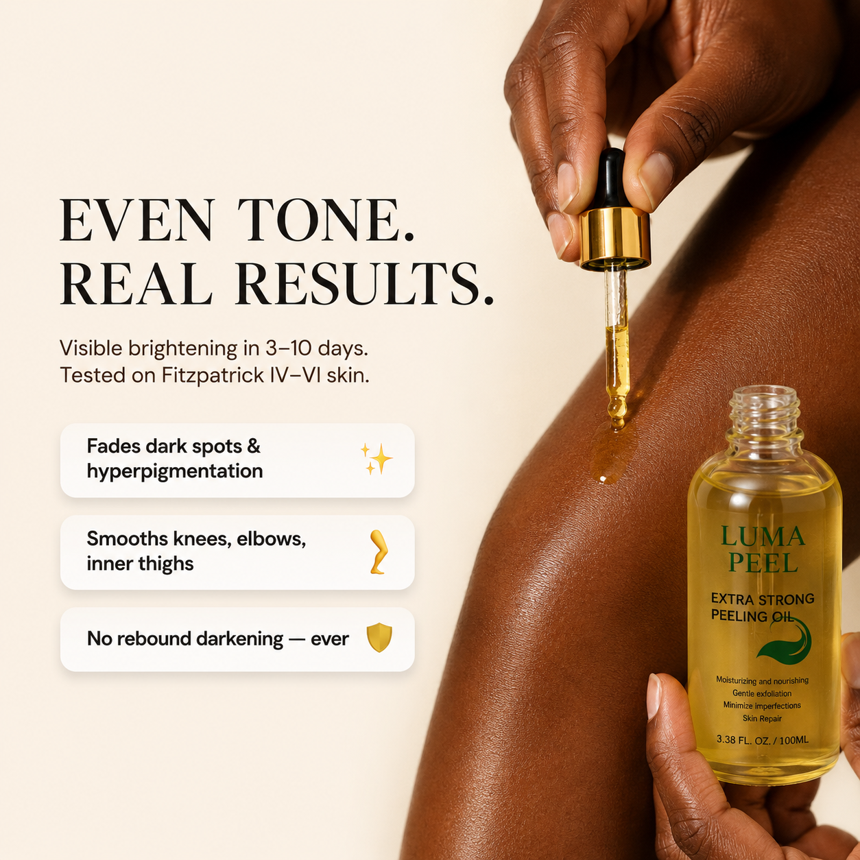 Luma Peel