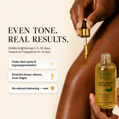 Luma Peel